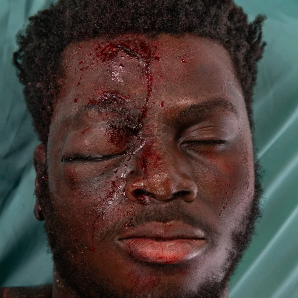 A man with a swollen eye and bloody wounds created from prosthetics and makeup